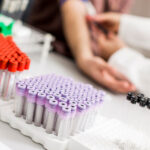 Laborvizsgálat az immunrendszer működésének és az általános egészségi állapotnak az ellenőrzésére