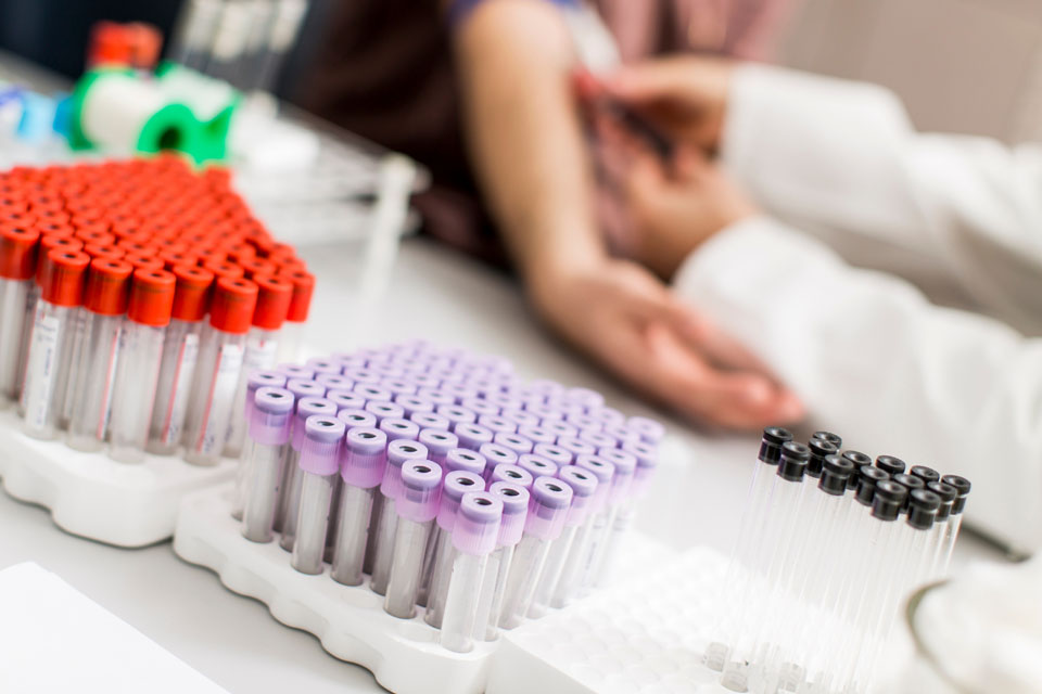 Laborvizsgálat az immunrendszer működésének és az általános egészségi állapotnak az ellenőrzésére