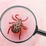 Lyme-kór diagnosztizálása laboratóriumi szűrőteszttel kullancscsípés után jelentkező tünetek esetén